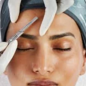 Dermaplane at Hans Esthetics in Plainfield, IL